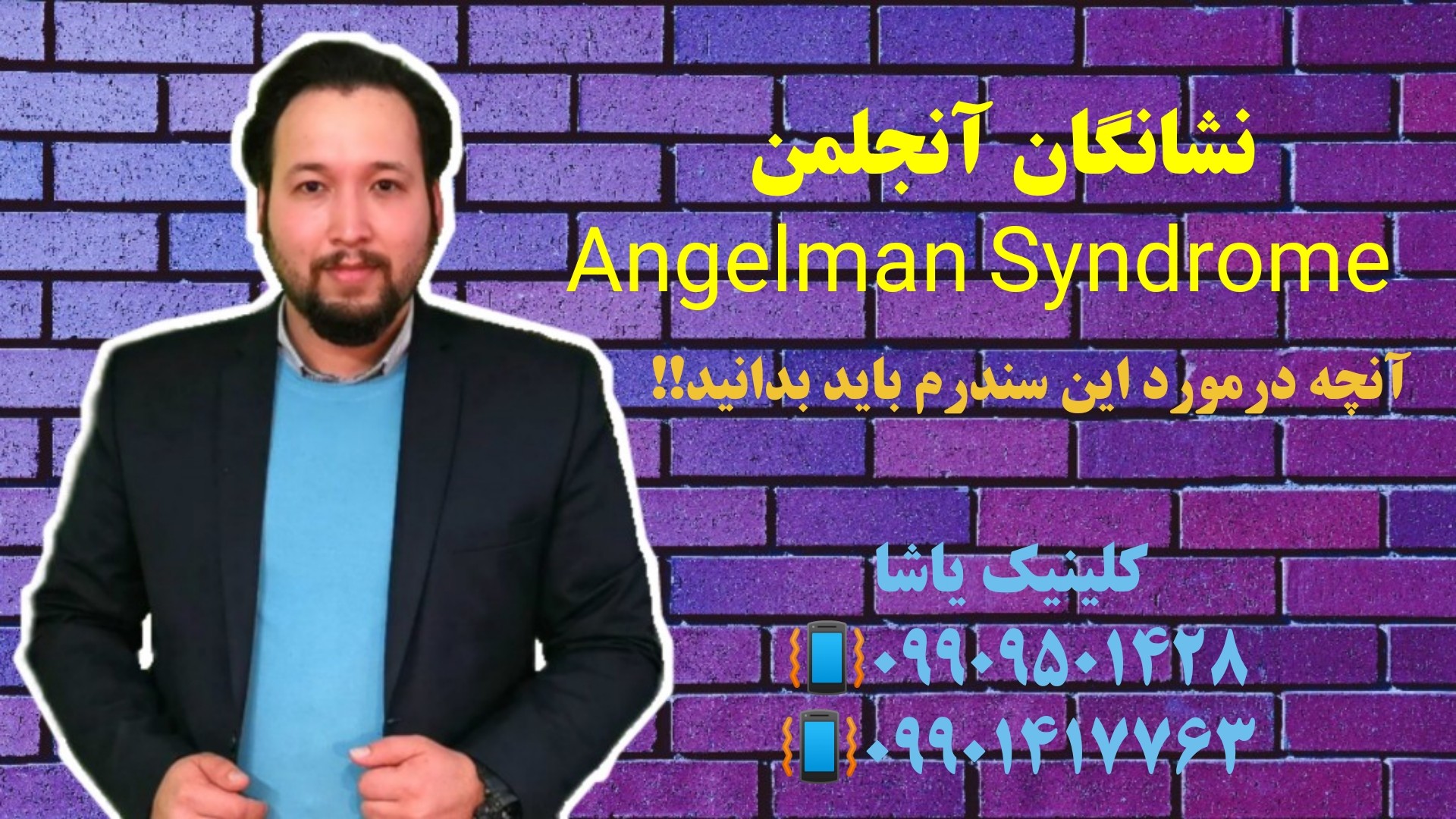 نشانگان آنجلمن 09909501428 کلینیک یاشا نشانگان آنجلمن 09909501428 کلینیک یاشا