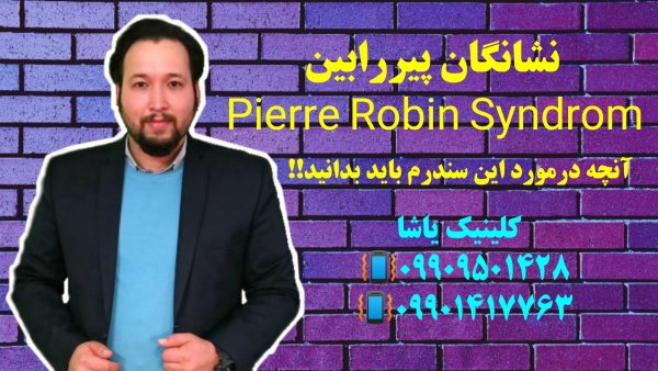نشانگان پیر رابین 09909501428 کلینیک یاشا