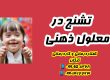 صرع در عقب ماندگی ذهنی ـکلینیک یاشا 09909501428