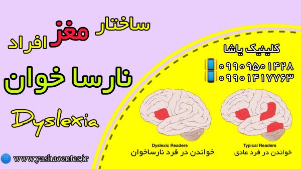 درمان اختلال یادگیری - کلینیک یاشا - عملکرد مغزی نارساخوان 09909501428