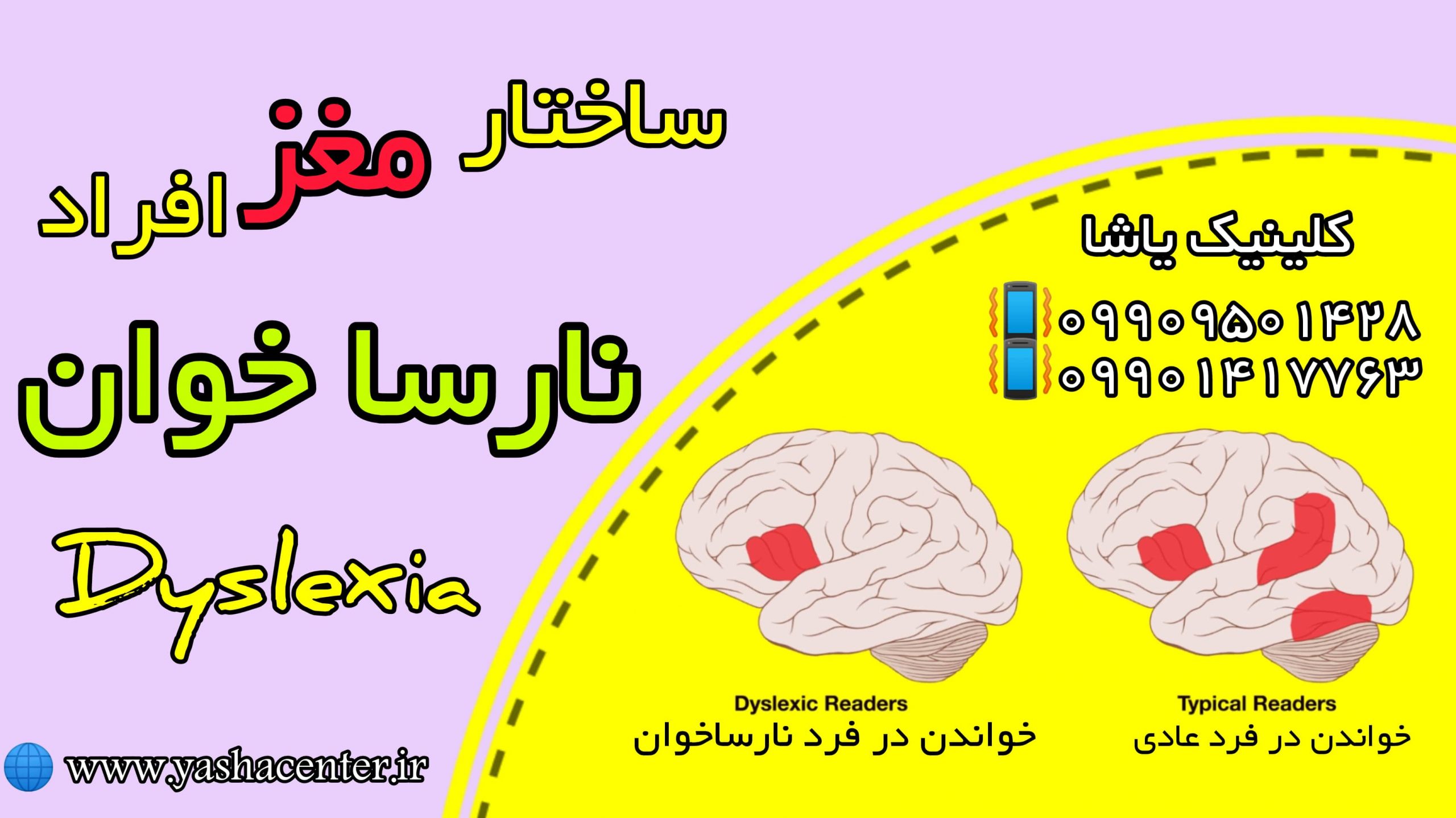 درمان اختلال یادگیری 09909501428 کلینیک یاشا (1) درمان اختلال یادگیری - کلینیک یاشا - عملکرد مغزی نارساخوان 09909501428
