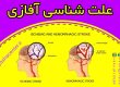 اتیولوژی آفازی و درمان آن 09909501428 حنیف امانیان