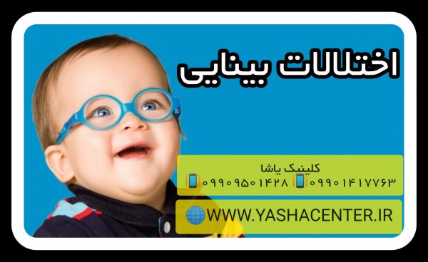 اختلالات بینایی کلینیک یاشا 09909501428