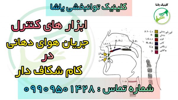 درمان کام شکاف دار کلینیک یاشا 09909501428