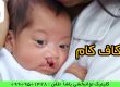 گفتاردرمانی در گرگان درمان شکاف کام