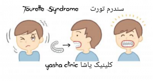 سندرم تورتtourette syndrome