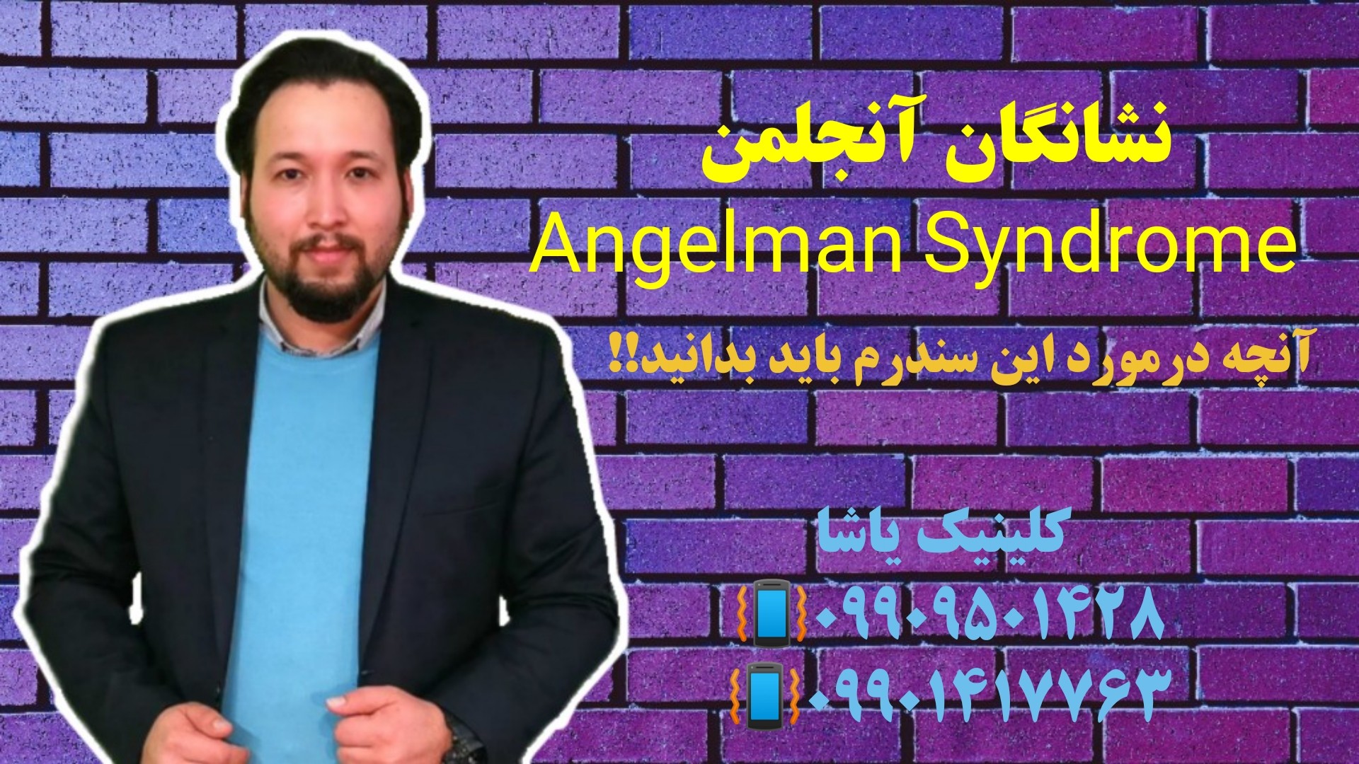 نشانگان آنجلمن 09909501428 کلینیک یاشا