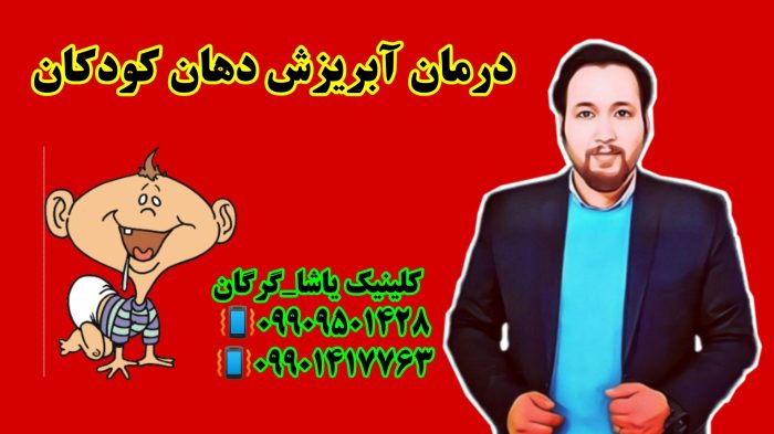 درمان آبریزش از دهان _09909501428 _گفتاردرمانی در گرگان