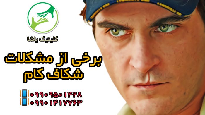 شکاف کام ـبرخی از مشکلات کودکان شکاف کام درمان گفتاری در شکاف کام - دکتر حنیف امانیان 09909501428