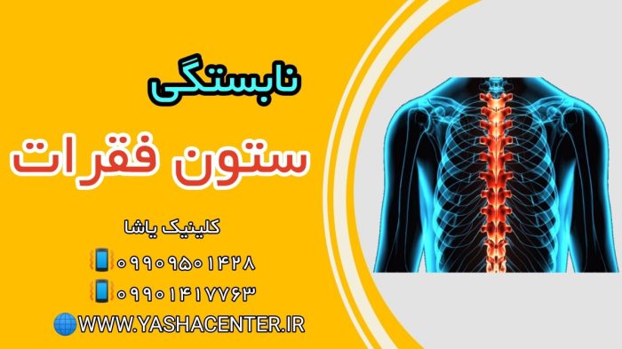 نابستگی ستون فقرات spina bifida کلینیک یاشا 09909501428