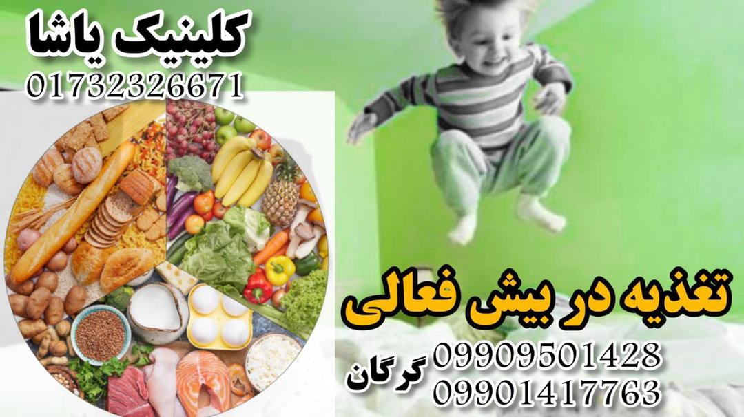 کلینیک یاشا ـ تغذیه در بیشفعالی ـ مشاوره تغذیه در گرگان 09909501428