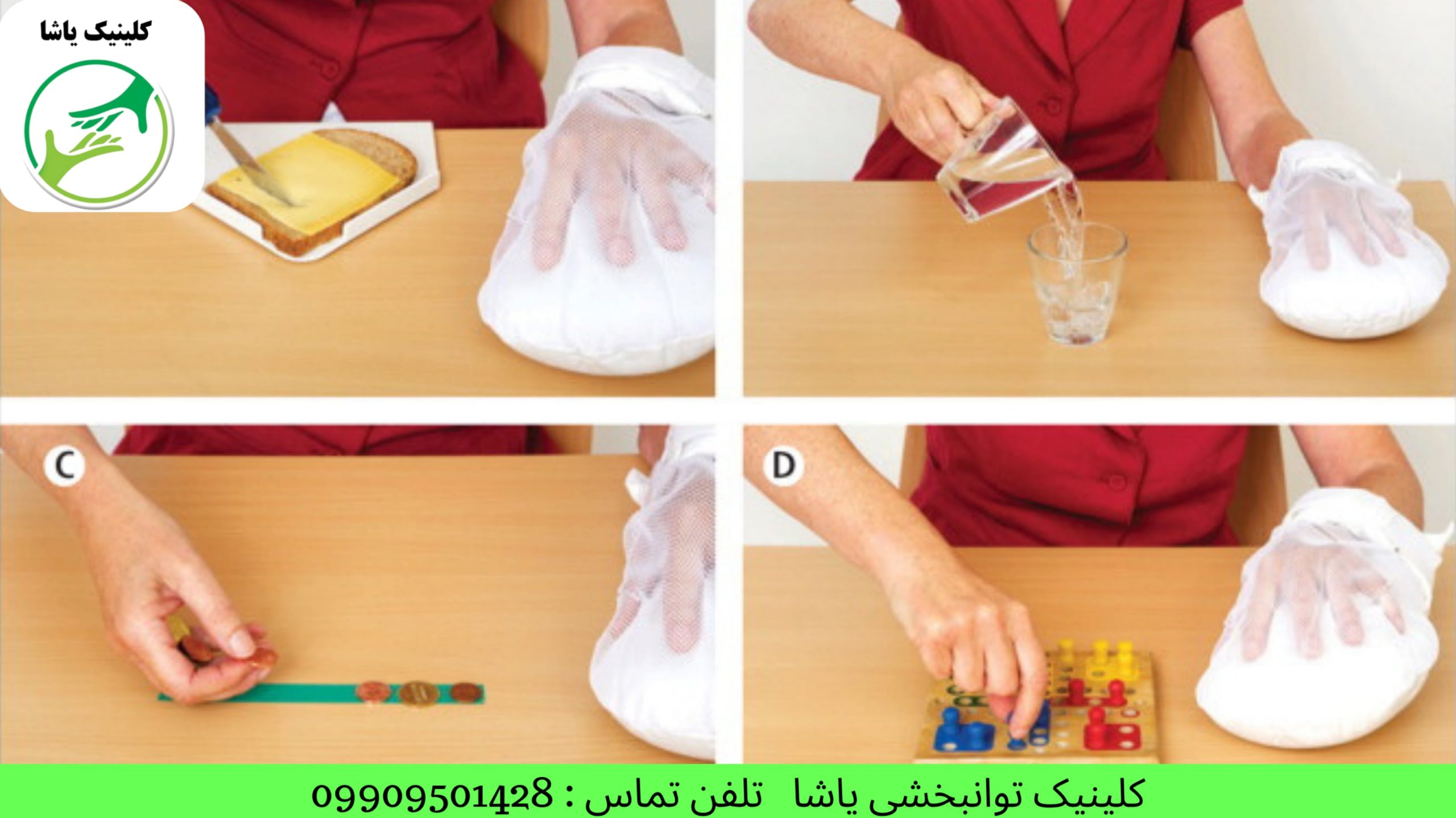 دزمان حرکتی در سکته مغزی - کلینیک یاشا