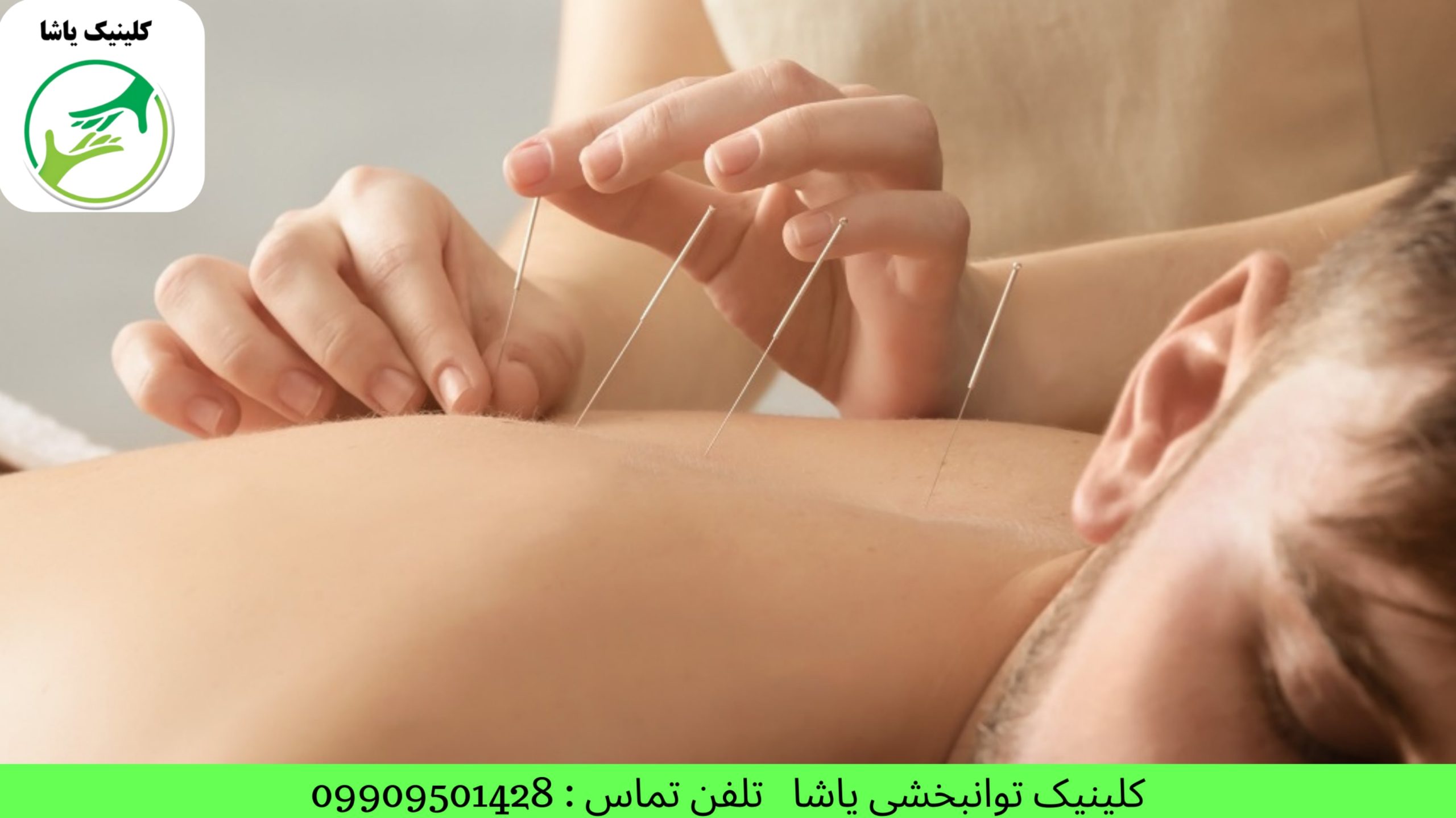 گفتاردرمانی در گرگان کاردرمانی در گرگان روانشاسی در گرگان درمان سکته مغزی در گرگان کلینیک توانبخشی یاشا 09909501428